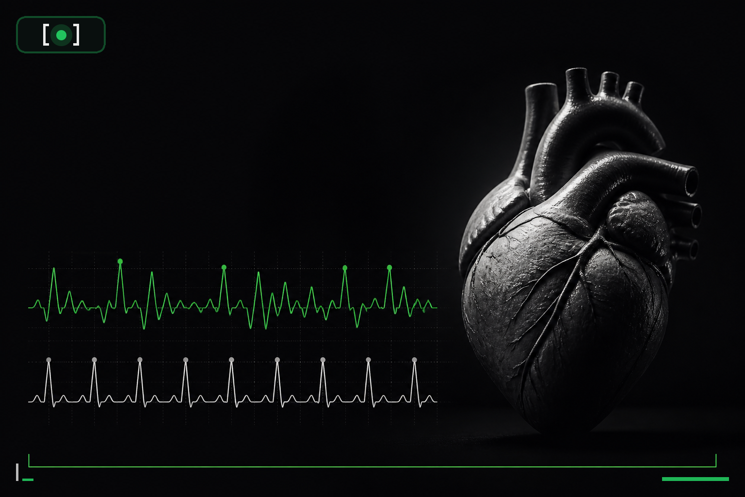 Cover image for Heart Rate Variability: The Physiology of the Autonomic Stress Signal